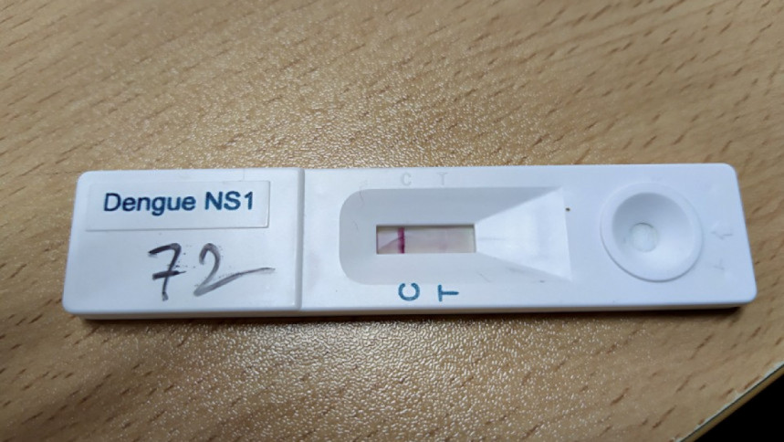 ডেঙ্গু পরীক্ষা: সরকারিতে ১০০ টাকা, বেসরকারিতে ৩০০ টাকা