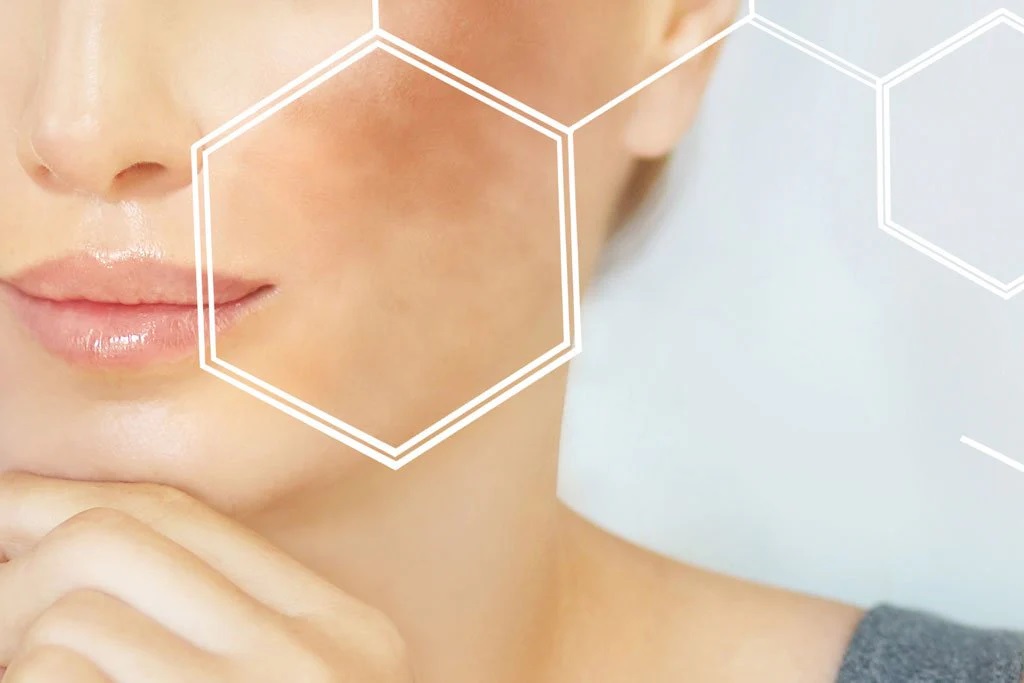 ত্বকে হাইপারপিগমেন্টেশন কেন হয়, প্রতিরোধ ও চিকিৎসা কী