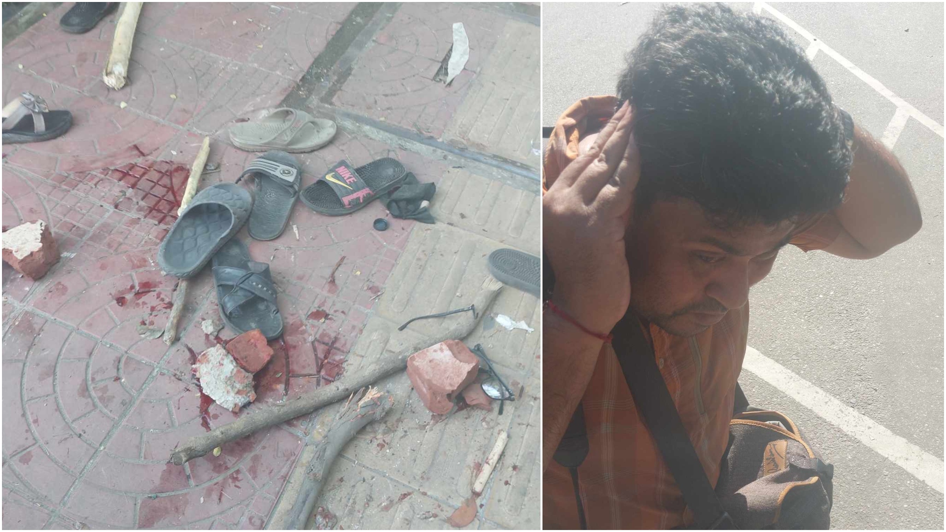 ঢাবিতে আন্দোলনকারীদের ওপর ছাত্রলীগের হামলা, ডেইলি স্টারের আলোকচিত্রী আহত