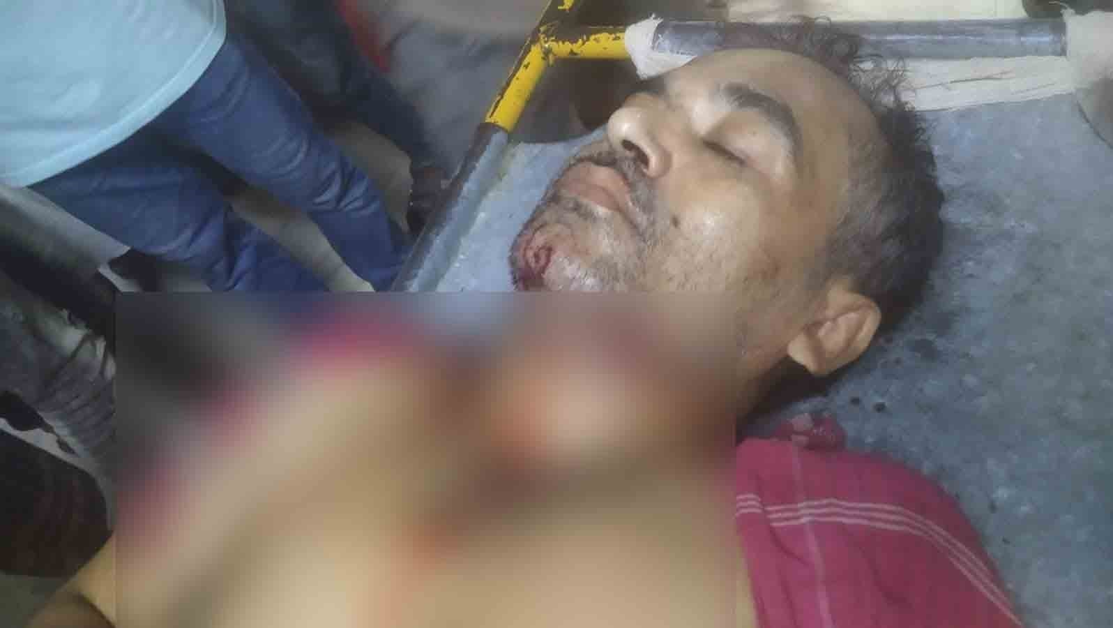 শনির আখড়ায় পুলিশের ছররা গুলিতে শিশুসহ আহত ৬