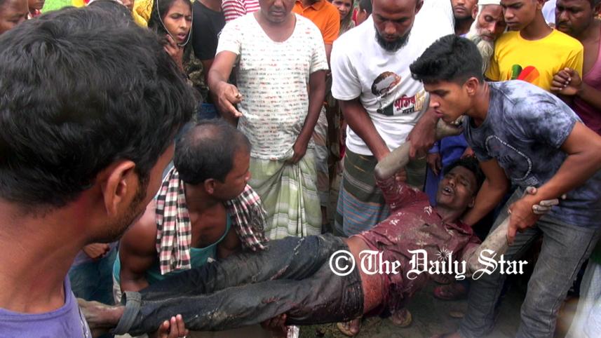 Lalmonuirhat BSF hurt.jpg