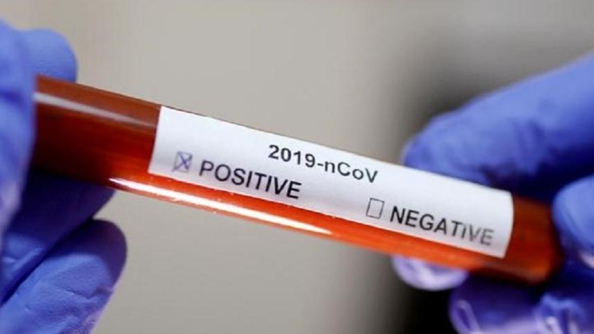 testing kit.jpg