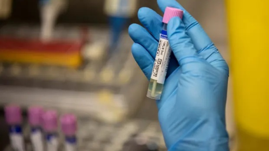 মাঙ্কিপক্স