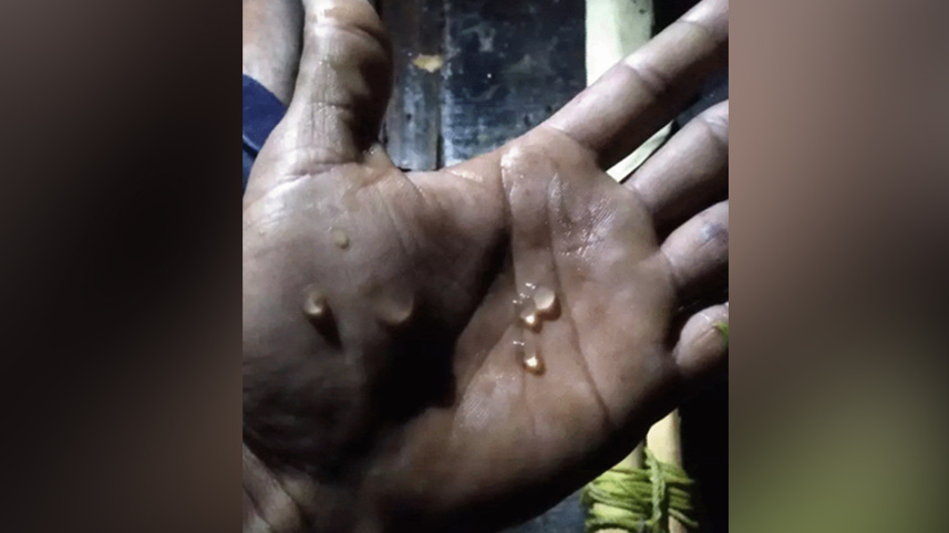 মিঠা পানি, হালদা নদী, চট্টগ্রাম, নমুনা ডিম,