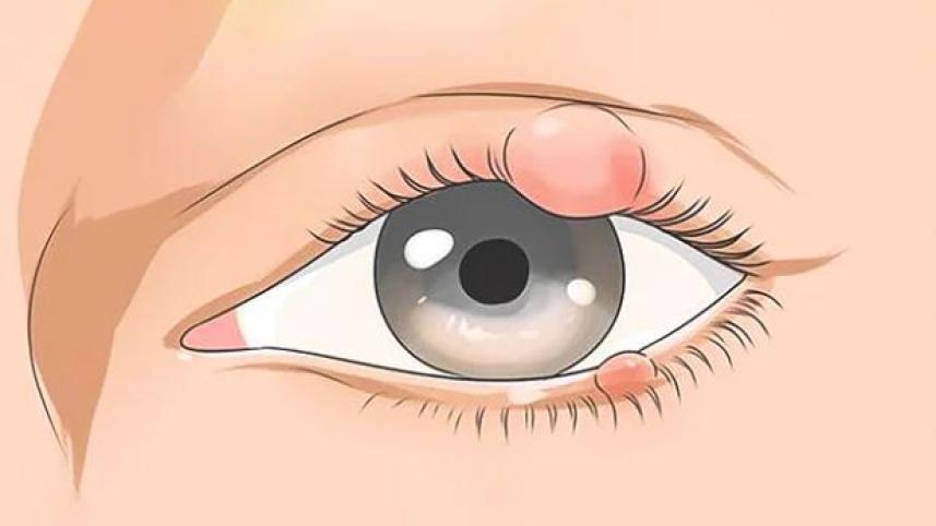 চোখে অঞ্জনি