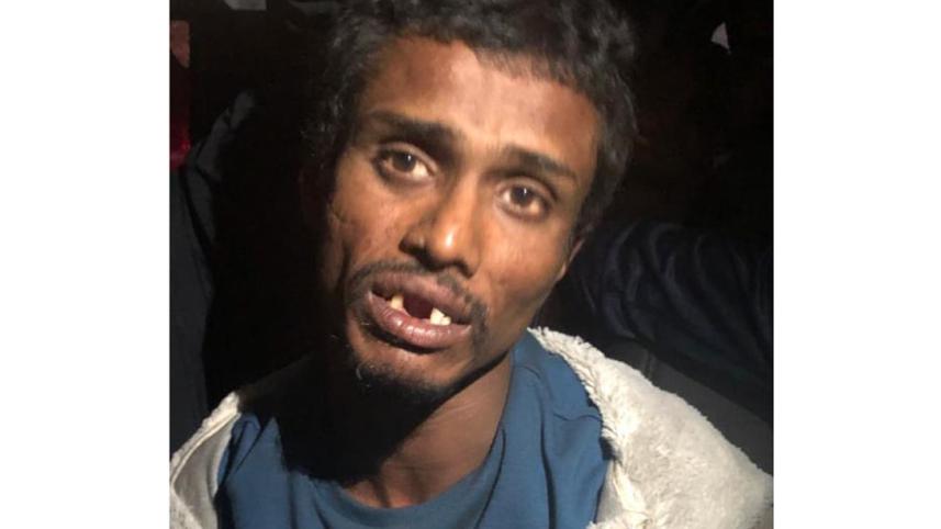 Majnu-Teeth-1.jpg