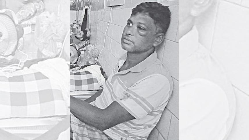 চোখে ছররা গুলি