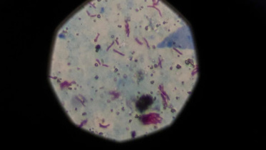 মালয়েশিয়ায় যক্ষ্মার প্রাদুর্ভাব, সতর্কতা জারি। ছবি: রয়টার্স