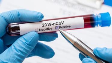 test_coronavirus-positive.jpg