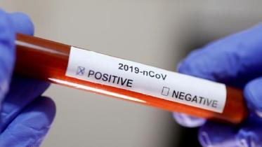 testing kit.jpg