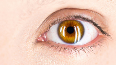 ইউভাইটিস