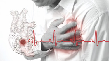 হার্ট অ্যাটাক