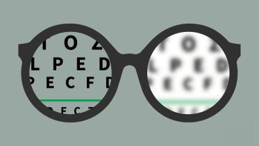 চোখের রোগ ‘মায়োপিয়া’ সম্পর্কে জানেন কি, আক্রান্ত হলে বুঝবেন যেভাবে