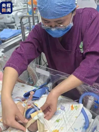 পিপলস হাসপাতালের নিওনেটাল বিভাগে কাজ করছেন চেন শানশান। ফাইল ছবি: সংগৃহীত